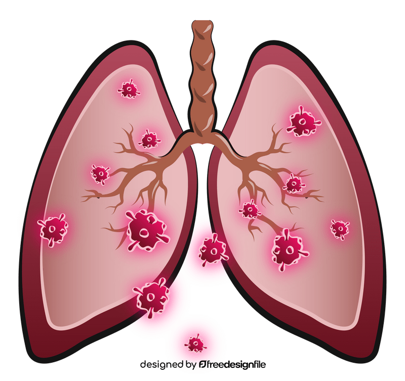 Covid 19, coronavirus pneumonia lungs cartoon clipart