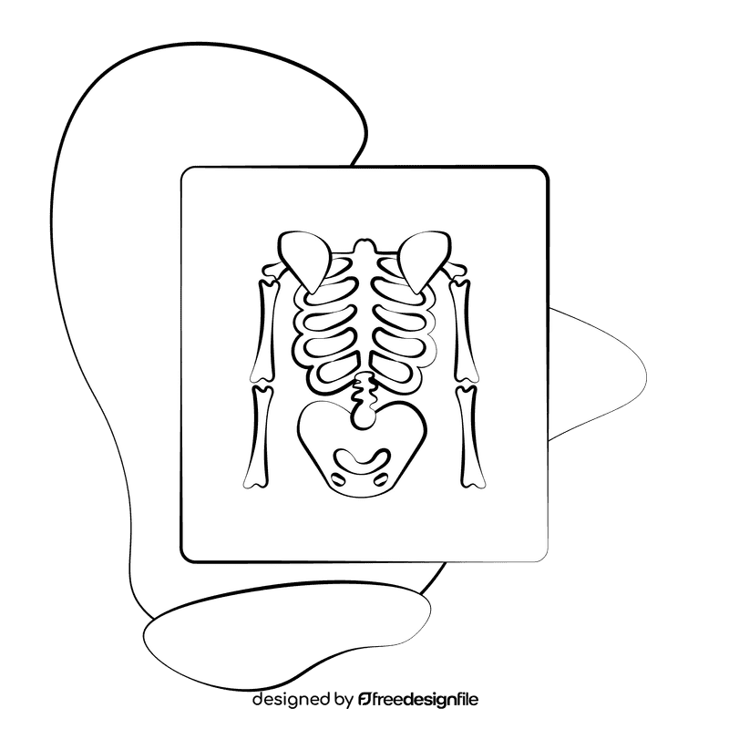 X ray black and white clipart