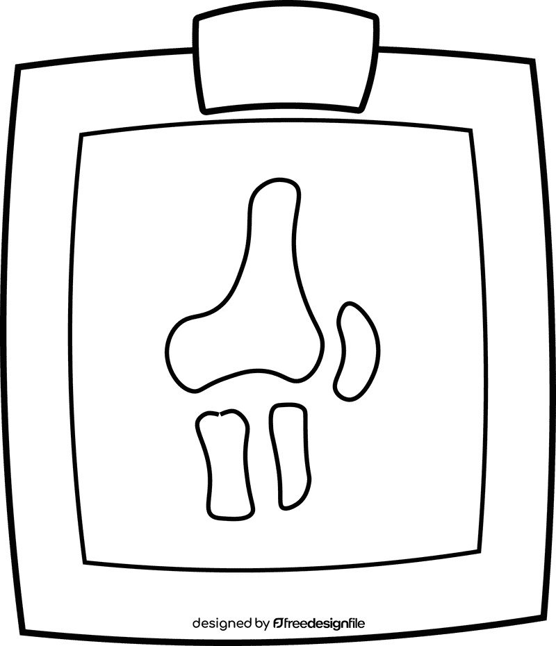 Knee X Ray black and white clipart