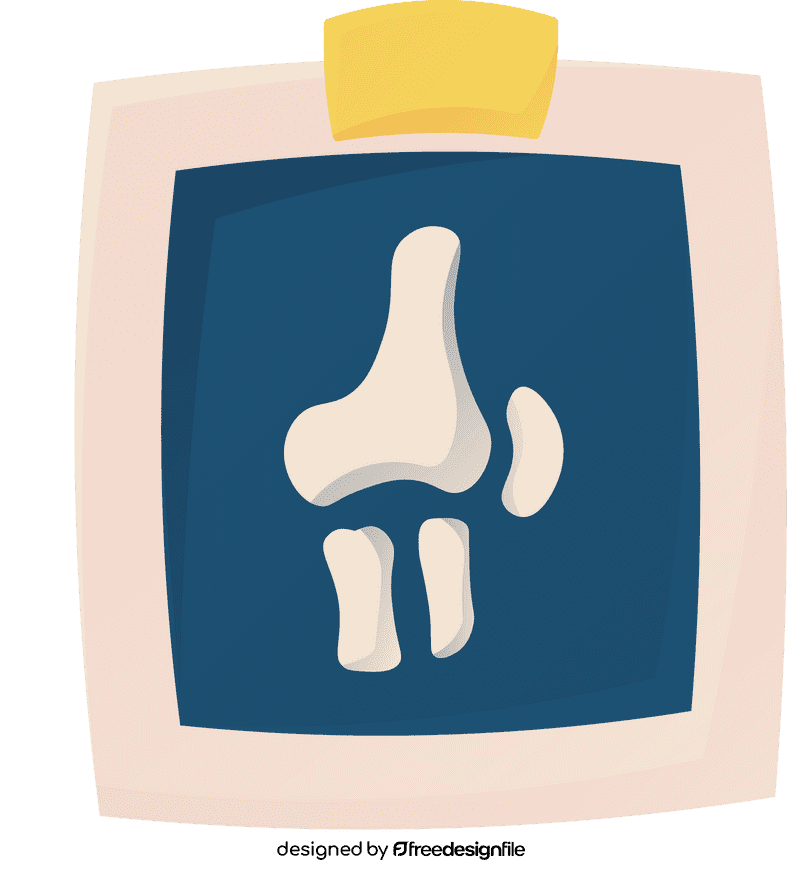 Knee X Ray clipart