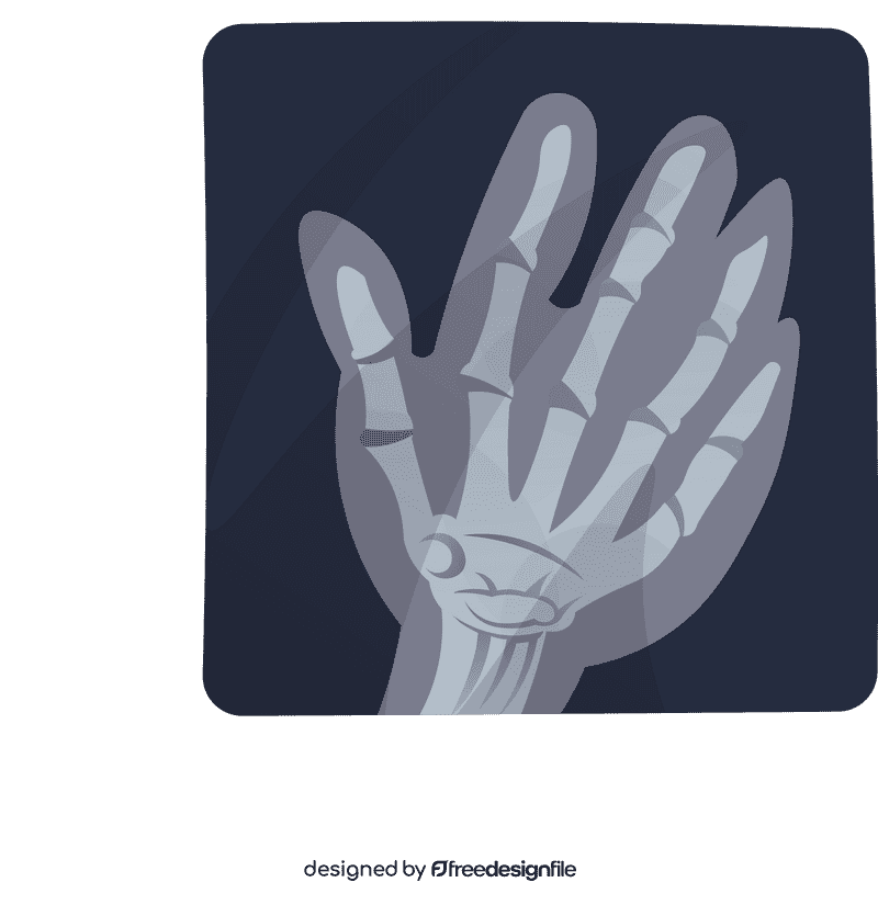 Xray Hand clipart