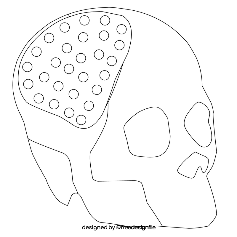 Skull implant 3d printing black and white clipart