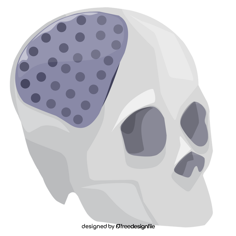 Skull implant 3d printing clipart