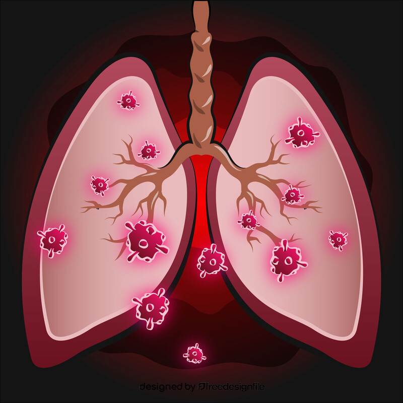 Covid 19, coronavirus pneumonia lungs cartoon vector