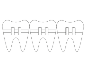 Teeth with orthodontic braces black and white clipart