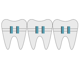 Orthodontic vector - for free download