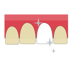 Cartoon teeth clipart