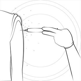 Flu shot black and white vector