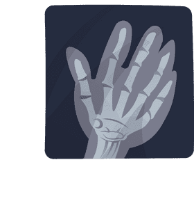 Xray Hand clipart