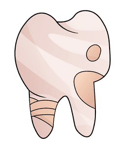 Tooth Damaged clipart