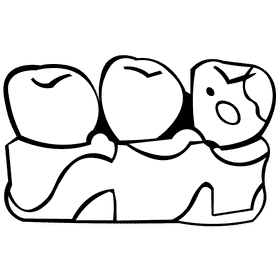 Toothache rotten black and white clipart