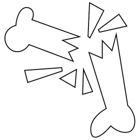 Bones broken black and white clipart