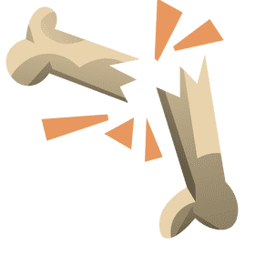 Bones broken clipart