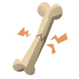 Bones damaged clipart