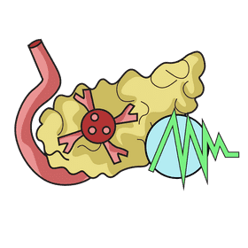 Cancer pancreas clipart