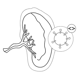 Spleen splenomegali black and white clipart