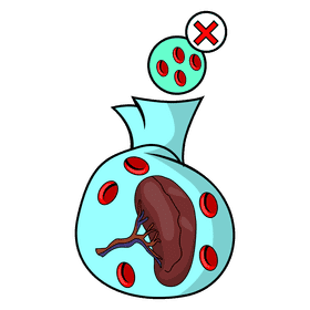 Spleen thrombocytopenia clipart