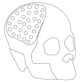 Skull implant 3d printing black and white clipart