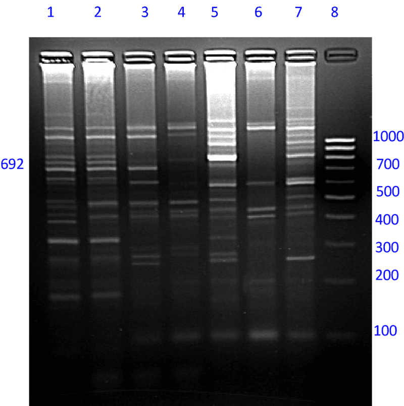 DNA Fragment Analysis Gel Electrophoresis Results PNG