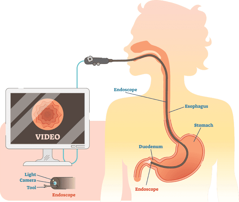 Ultrasound Imaging for Digestive Health PNG