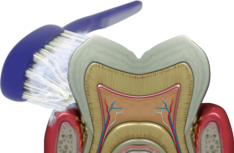 Impact of Bacteria on Dental Health PNG