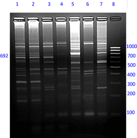 DNA Fragment Analysis Gel Electrophoresis Results PNG