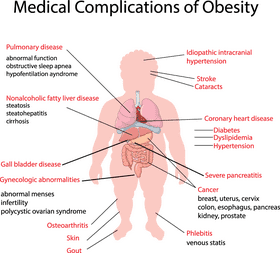 Understanding Medical Syringe Applications in Obesity Treatment PNG