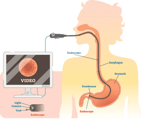 Ultrasound Imaging for Digestive Health PNG