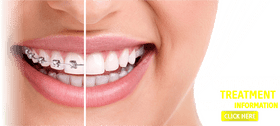Dental Transformation Braces to Bright Smiles PNG