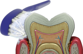 Impact of Bacteria on Dental Health PNG