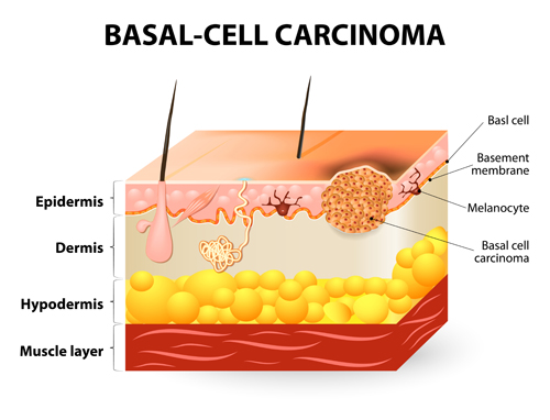 Skin structure diagram vectors material 02