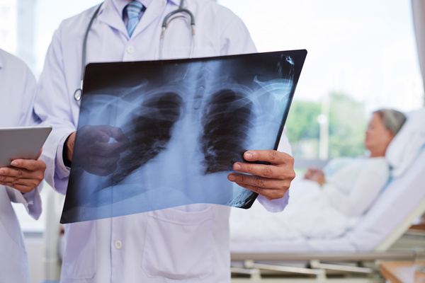 The doctor saw the patients chest X-ray Stock Photo