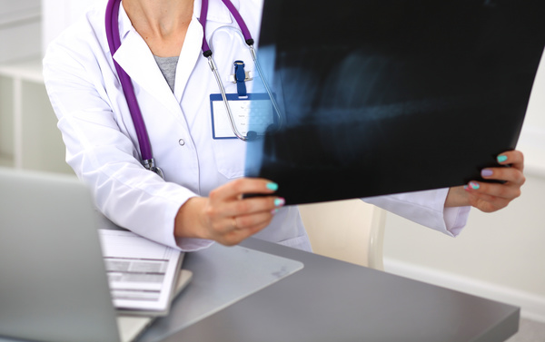 The doctor looks at the patient X ray Stock Photo 03
