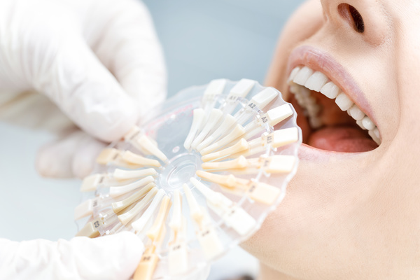 Compare patients dental samples Stock Photo 04