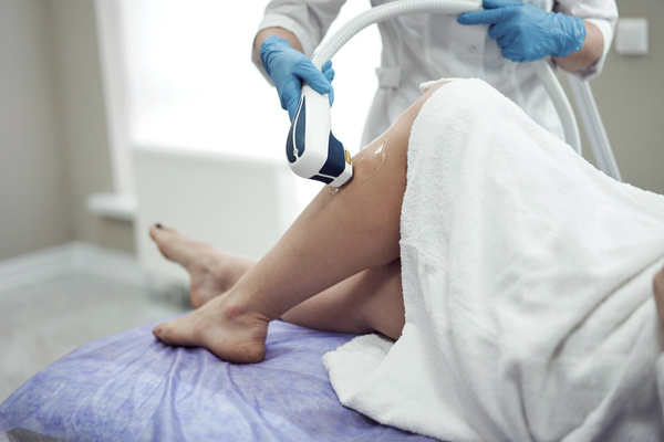 Laser hair removal for womens legs Stock Photo