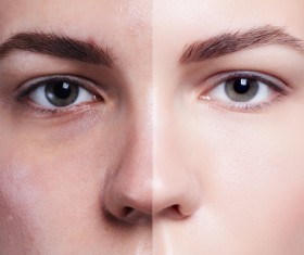 Beauty skin care before and after comparison Stock Photo 01