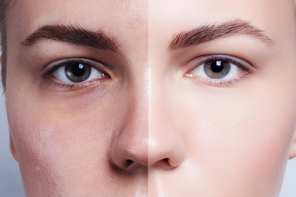 Beauty skin care before and after comparison Stock Photo 01