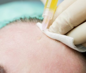 Forehead Beauty Botox Injection Stock Photo 03