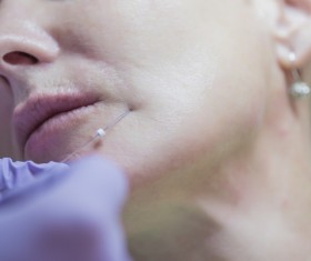 Middle-aged female facial botox injection Stock Photo 07