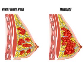 Healthy fenale breast structure vector