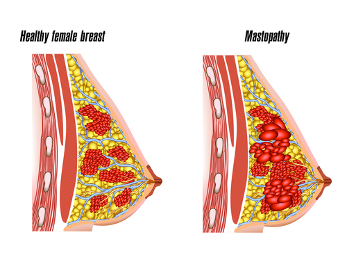 Healthy fenale breast structure vector