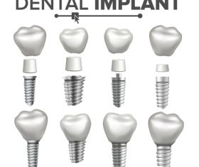 Decomposed dental implant vector