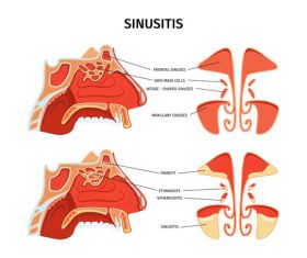 Nose sinusitis anatomy Illustration vector